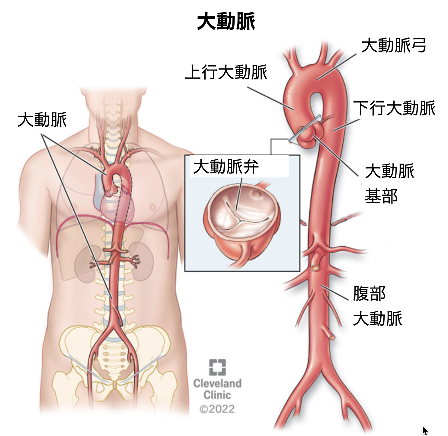 高血圧7　-　高血圧と大動脈瘤